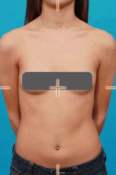 Example of Frontal Body View