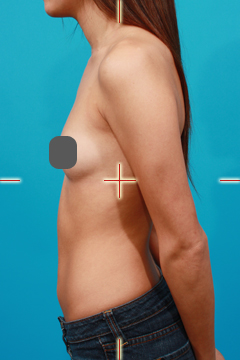 Example of Profile Body View