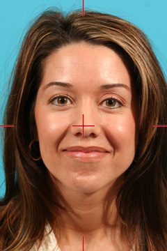 Example of Frontal Face View